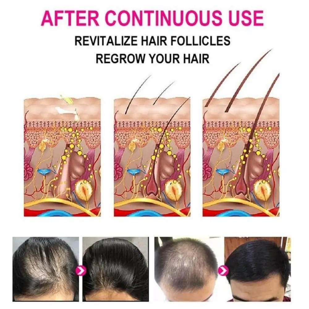 Ganoderma Nutrient Hair Essence – Natural Darkening & Hair Recovery