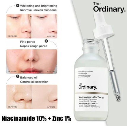 The Ordinary Niacinamide 10% + Zinc 1% – Pore-Refining Serum for Clear Skin